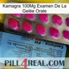 Kamagra 100Mg Examen De La Gelée Orale 35